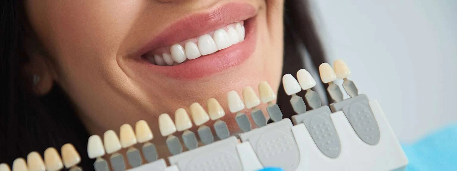 How Dentists Make Veneers Affordable for Patients 