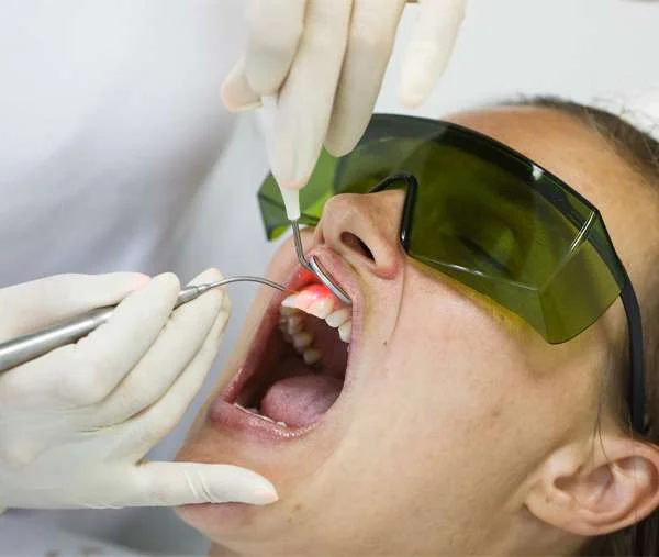 LANAP Laser Dentistry