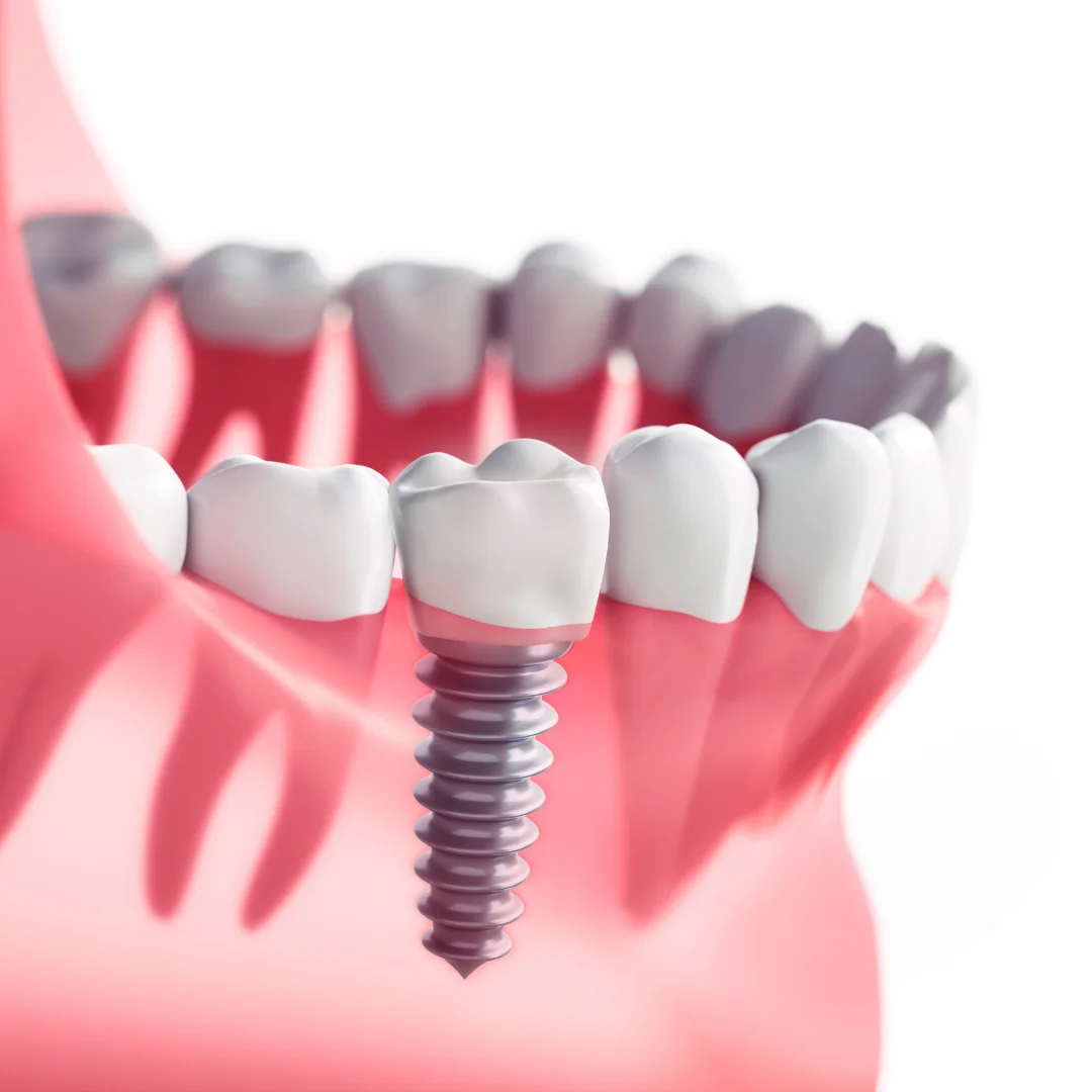 Restorative Dentistry